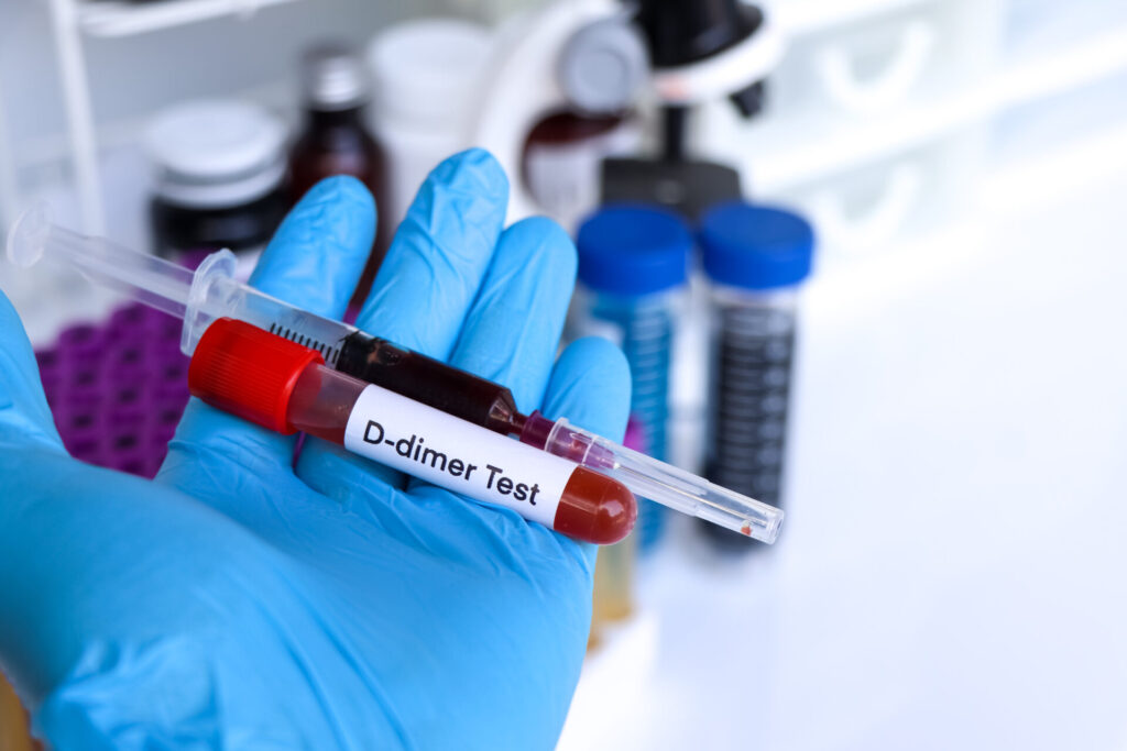 D-dimer