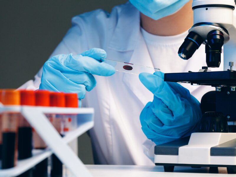 Hands,Of,A,Laboratory,Worker,Doing,Blood,Test